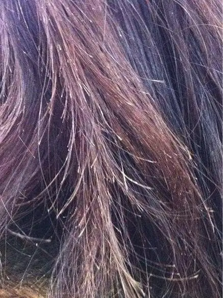 发质受损的表现有很多种,其中最常见的就是头发分叉