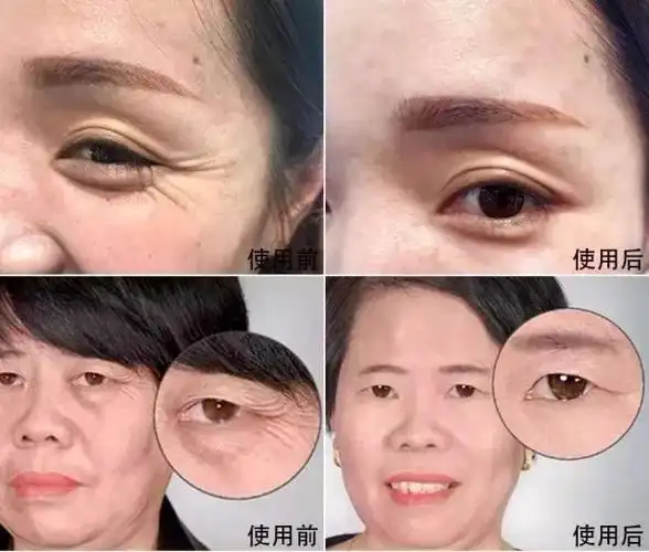 眼袋|细纹|眼霜|黑眼圈_网易订阅