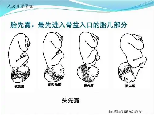 胎姿势胎产式胎先露胎方位90646