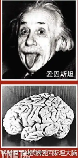 爱因斯坦大脑被切成240块图