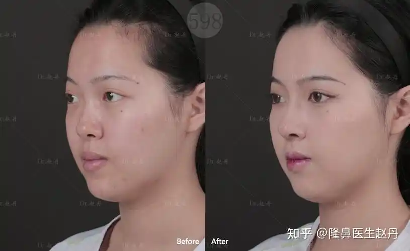 一塌毁所有你以为鼻子高就好看了吗