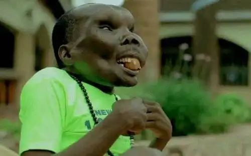 乌干达最丑男人靠脸吃饭,结婚两次已有8个孩子(图)