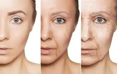 肌肤老化的表现及形态分析,医美治疗选择全解析