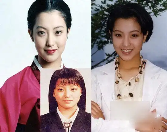 金喜善金喜善:有传闻金喜善很早就整容了,并且容貌多次修补,如今的