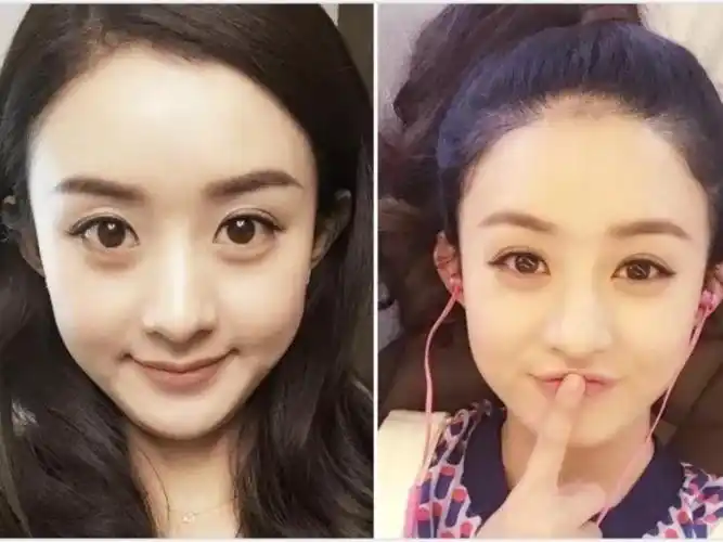 原本杂乱的前额发际线,变成了圆形光滑的发际线,更适合赵丽颖圆脸的