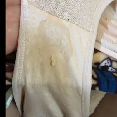 问答 怀孕期 育儿问题这裏搜 取消 最佳回答          白带,我33周就