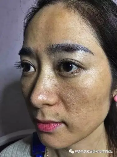 问题性皮肤如何改善的秘密课堂