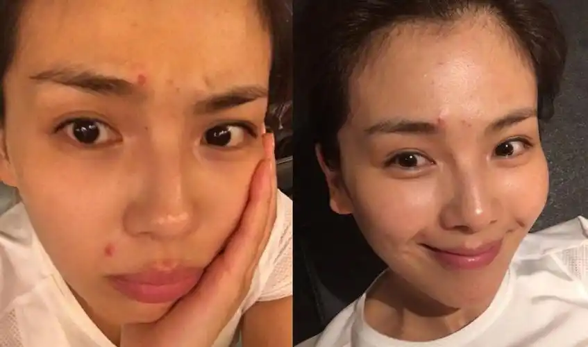 关掉滤镜和美颜女明星的真实素颜一个比一个不上镜