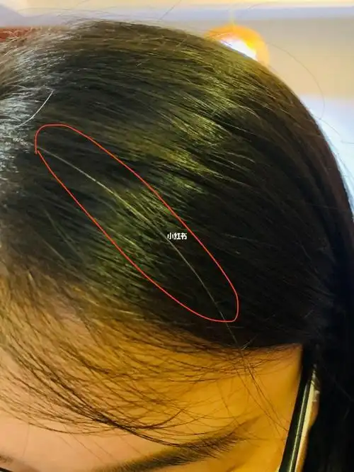 天呀我竟然有了一根白头发05