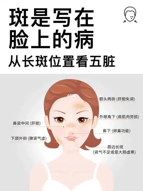 斑是写在脸上的病,从长斑位置看五脏