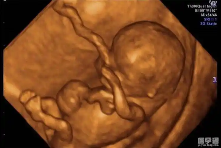 四维看男孩女孩诀窍,让你对孩子性别一看便知 - 医孕通