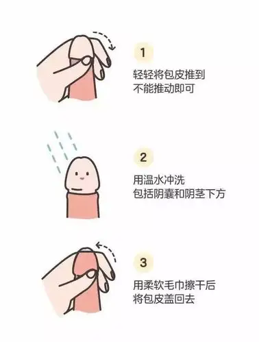 之前可伸缩的包皮变为不可伸缩病理性包茎