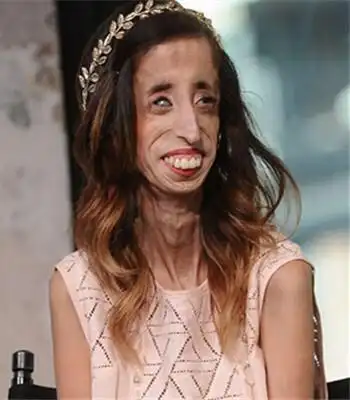 口吃本质解析音频讲座第11讲