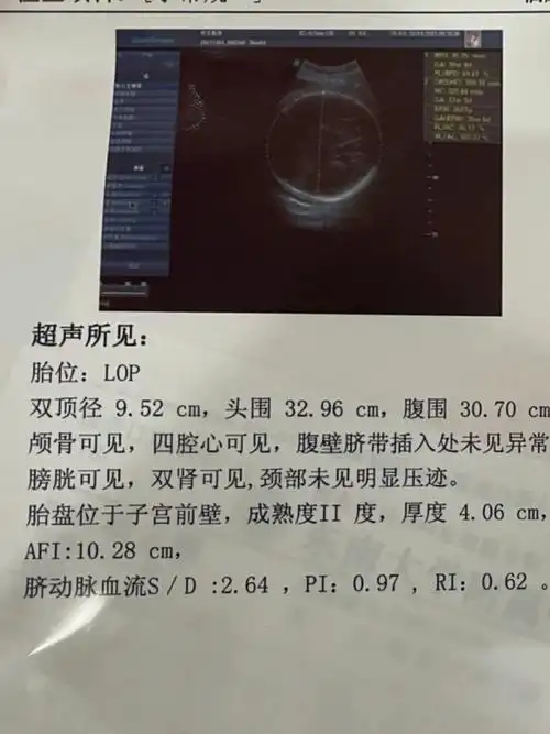 36周双顶径9.52好焦虑