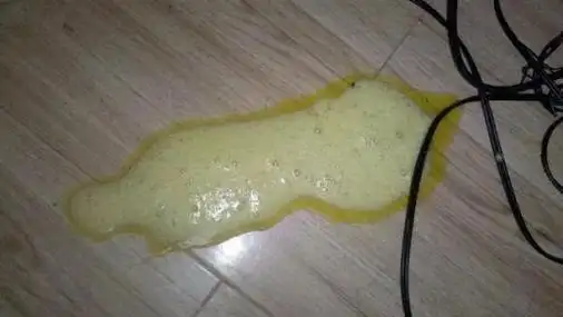 如果呕吐物的颜色是黄绿黄绿,说明胆汁已经吐出来了.