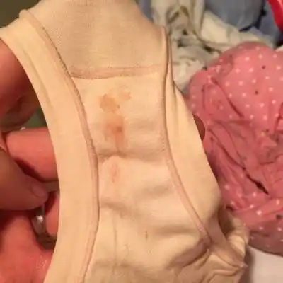 确认怀孕后,每天不经意间内裤上会有一点点的血迹,前几天为咖啡色,这