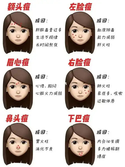 每个部位长痘痘都有不同的反射区?