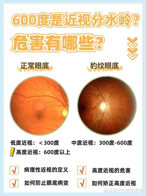 600度是高度近视分水岭?
