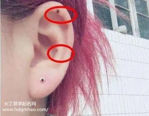 大致分为以下几种解析:耳轮有痣,聪明;耳廓有痣,长寿;耳垂有痣,钱财