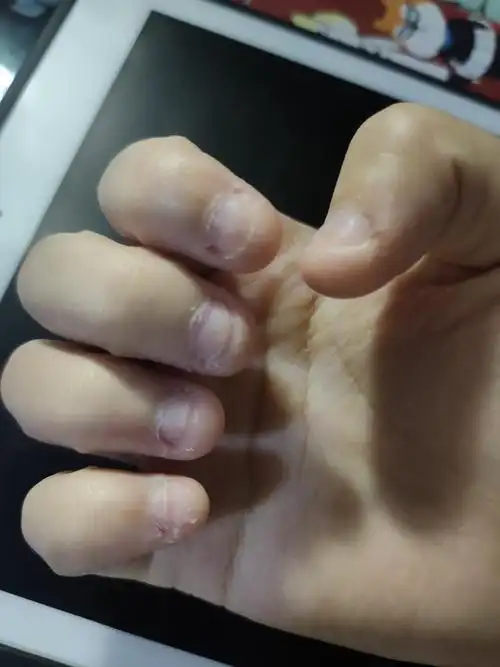 上面两张已经是我注意保养两年的结果,期间啃指甲一直没断过