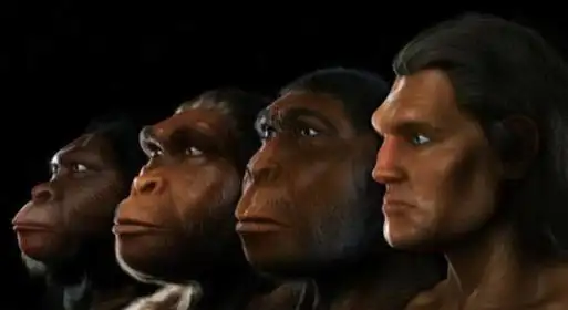 "美人三分龅" 龅牙会让人更美?