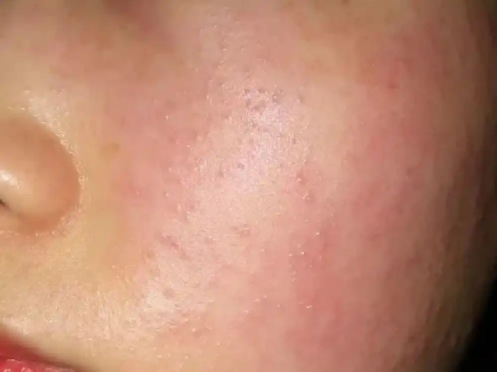 敏感肌护肤的正确步骤?哪些男士洗面奶敏感肌非常适合?