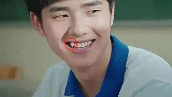 孩子的虎牙要不要拔掉小孩牙齿矫正最好几岁