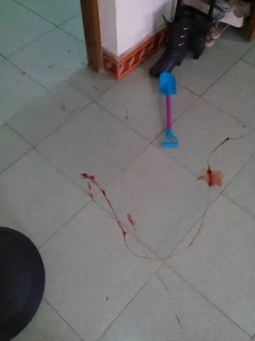 清早起床,看见地上一摊血,是凶兆吗?