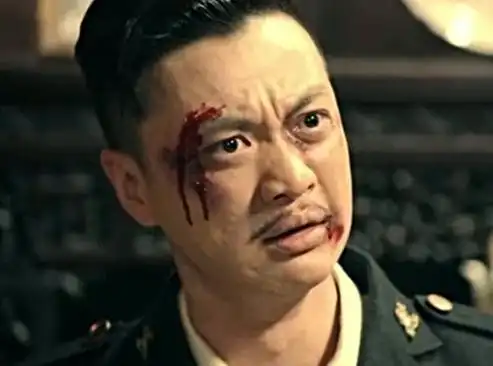 梦见自己脸受伤流血