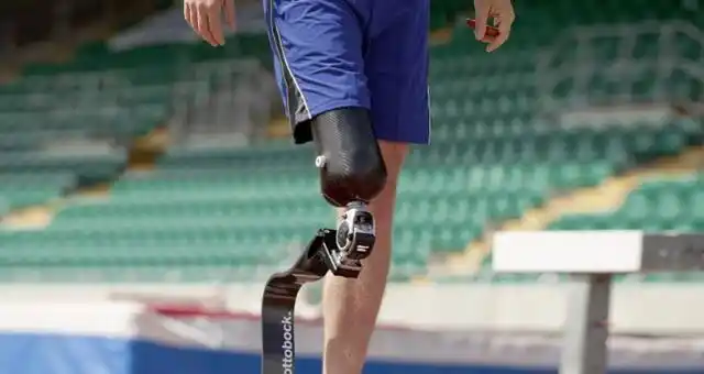 假肢脚的常见类型分类介绍