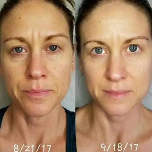 下面来看看前后对比效果图吧