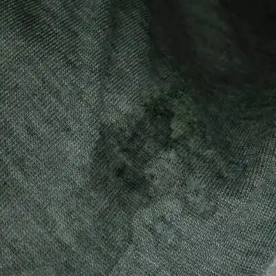 孕5个多月 内裤上有水渍样 你们有吗?