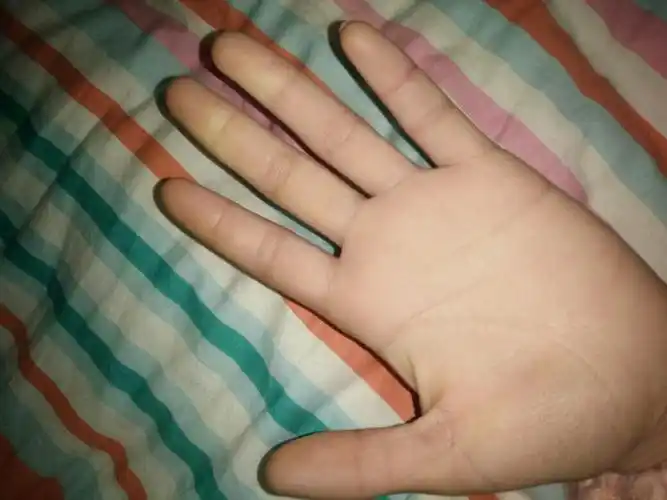 我的手指特别长,这是怎么回事?
