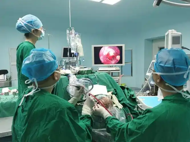 省医在河源名医在身边神经外科一区完成首例内镜下脑内血肿清除术