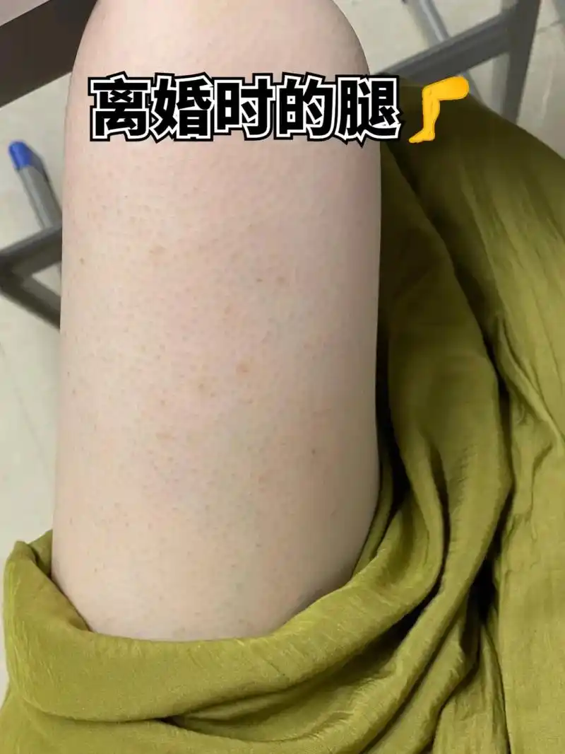 多亏了闺蜜告诉的好办法#鸡皮肤 拜拜喽!#抖音图 - 抖音