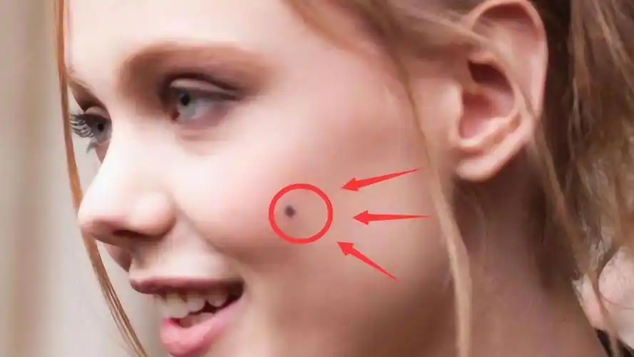 脸上有这3种富贵痣的人男升官女发财一生非富即贵