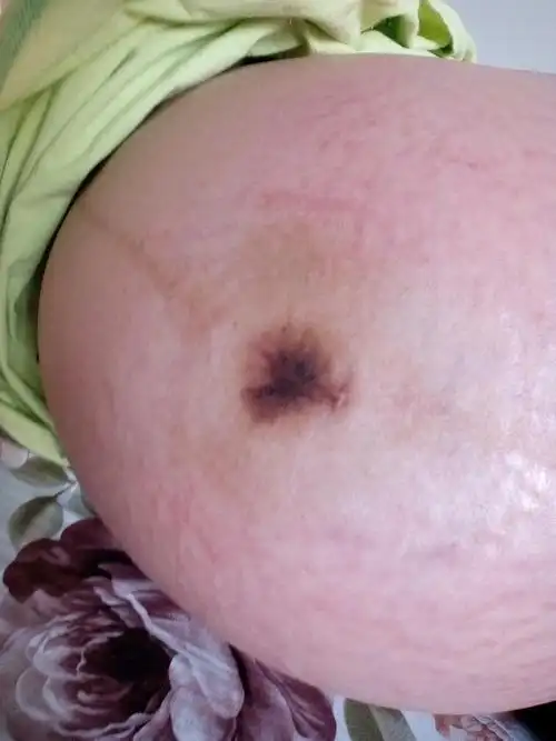 有宝妈的肚脐眼和我一样黑的吗?