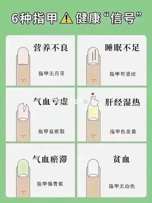 指甲上的月牙,越多越健康指甲有竖纹,代表体质差_功效与作用