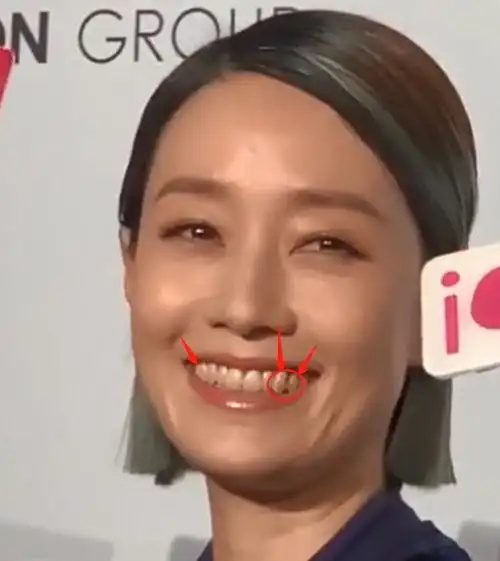 45岁马伊俐生图曝光,一口黄牙污垢明显,网友:好恶心|马伊琍|牙齿_网易