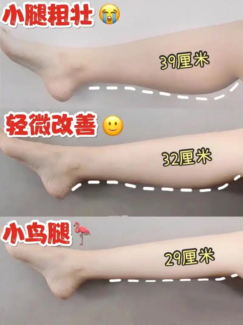 小腿粗壮,肌肉发达01你就这样练.坚持2周,腿会变细变直#瘦 - 抖音