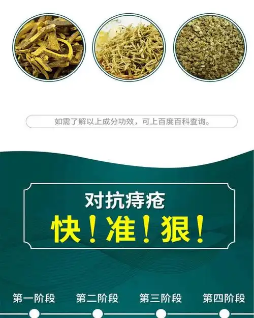 苗家膏肉球消内痔外痔混合药痔断膏克星肛门骚痒1支15克装带3个导管