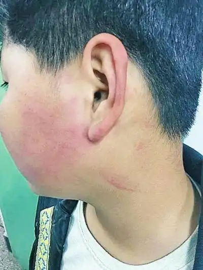 学生无意撞开校长门被打:涉事校长被责令辞退