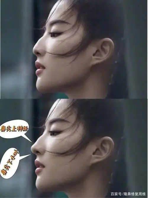 同样是驼峰鼻,为什么刘亦菲的驼峰鼻就很好看?