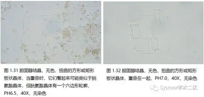 高清图谱尿液结晶形态汇总