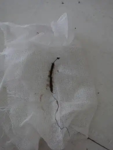 我09年上的吉尼环,前几天把环取了,可是医生告诉我应该没有取完,之后