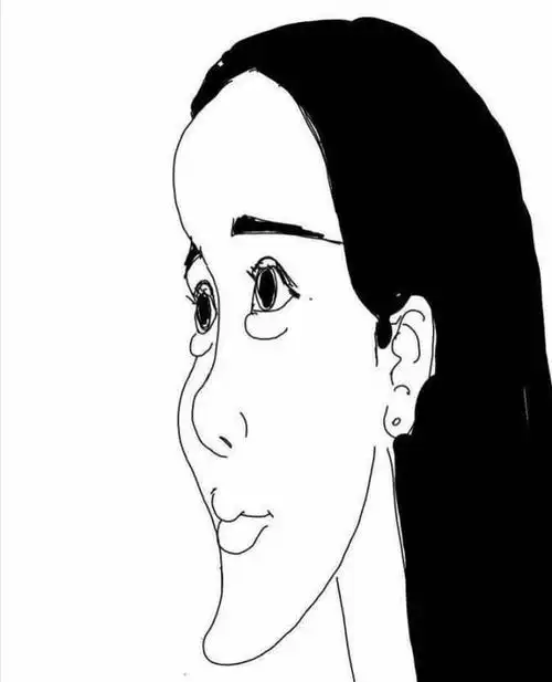 do脸必看整容不假脸75全攻略鹤鹤最近看到一个小姑娘整容前后的对比