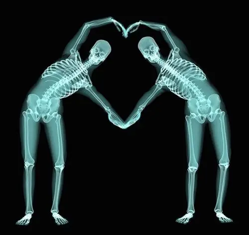 "x射线"下的"骷髅人"告诉我们:爱无标签