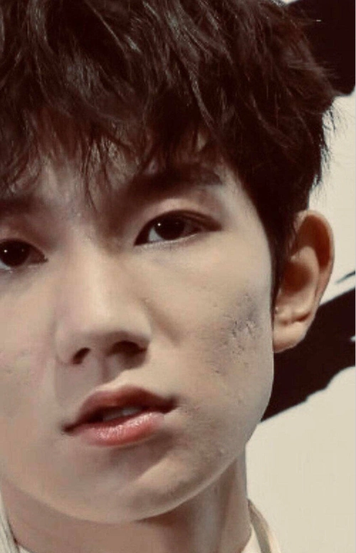 tfboys未修图曝光,王源脸部如月球表面!网友:烟抽太多吧