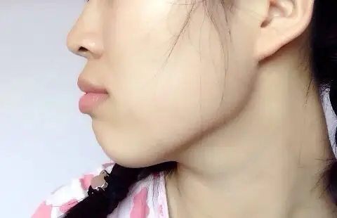 内地嘴突女歌手_内地实力女歌手_嘴突男