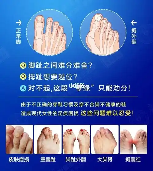 拇外翻和正常脚的区别